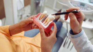 Why Choose Dental Implants in Westwood for Long-Lasting Smile Restoration